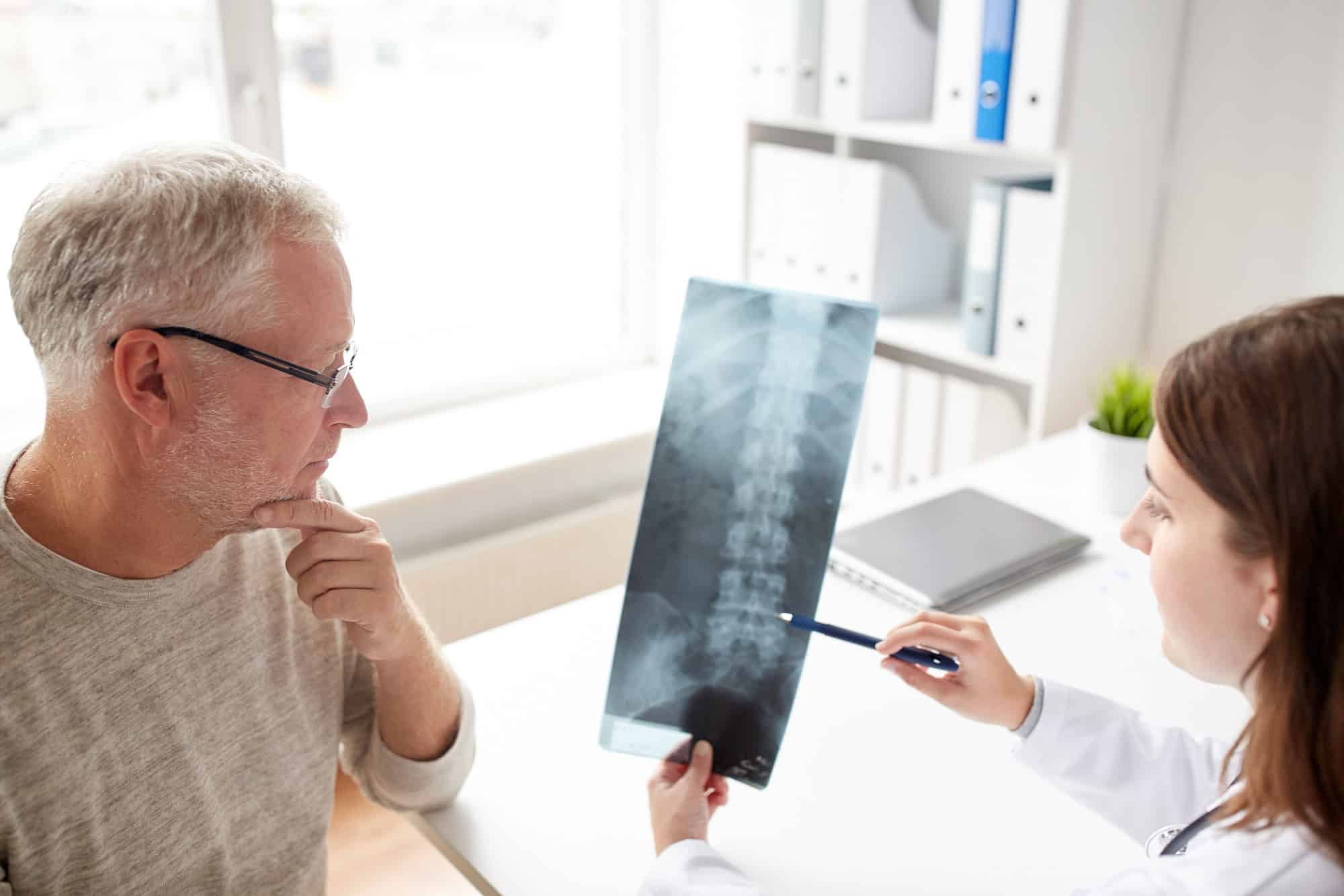 Spinal Cord Stimulator Implant And How It Can Help You - OAS